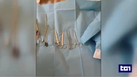 Chirurgo sospeso dall'ordine sorpreso mentre continua ad operare in un appartamento