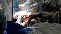 Operata al cervello per Parkinson, Denise suona il clarinetto durante l'intervento: "Bellissimo"