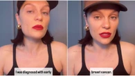 "Ho un cancro al seno, sparisco per un po'": il video con l'annuncio di Jessie J