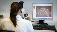 Virus West Nile, 12 nuovi casi nel Lazio, tutti a Latina. I sintomi a cui prestare attenzione