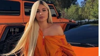 Viral Wajah Kylie Jenner 10 Tahun Lalu, Beda Banget!