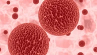 Hits Health: Ancaman Virus Marburg, Perubahan Tubuh yang Jadi Tanda Kematian Dini
