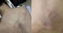 Nóng: Bé gái 4 tuổi bị cô giáo mầm non công lập ở Hà Nội bạo hành dã man, trích xuất camera phát hiện hành động gây sốc