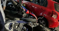 Vụ tai nạn liên hoàn ở Hà Nội: Nạn nhân kể lại giây phút bị ô tô tông trúng, tỉnh dậy đã ở trong viện