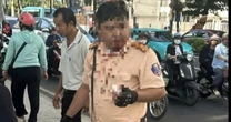 Phân định pháp lý vụ một Trung tá CSGT bị thanh niên người Nga tấn công