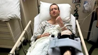 Mark Zuckerberg in ospedale, la sua carriera come lottatore di MMA non sta andando benissimo