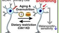 Un cambiamento di forma nelle cellule del cervello ci fa ingrassare: visto per la prima volta cosa succede