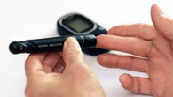 Farmaco antidiabetico associato a bolle pruriginose sfociate in endocardite e sepsi: il caso clinico