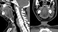 Come capire se si è allergici al mezzo di contrasto della TAC e di altri esami radiologici