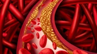 Nuovo vaccino abbatte il colesterolo alto del 30% in laboratorio: costa meno dei farmaci