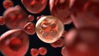 Tumore al seno, una proteina può prevenirlo: uccide le cellule malate prima che diventino cancerose
