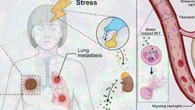 Perché lo stress “aiuta” il cancro: visto per la prima volta come fa a promuovere la diffusione dei tumori
