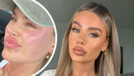 Skye Wheatley reveals dramatic new look under her bandages