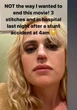 Rebel Wilson feared she'd be 'permanently disfigured' after 'freak accident' on set