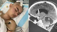 The life-saving discovery made after teen’s ‘lucky’ head knock