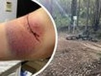 Perth Now exclusivePolice probe sinister wire trap set on popular bush track