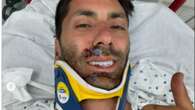 Nev Schulman back on his feet after breaking his neck