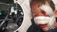 E-bike rider hit and run leaves boy with nose hanging off