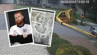 Perth man lucky to survive after 7m cherry picker fall