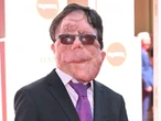 Adam Pearson 'beyond honoured' to star in Elephant Man remake