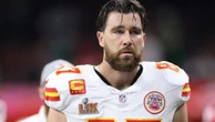 Has Travis Kelce had a hair transplant?