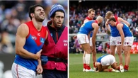 Demons star‘s horror injuries revealed