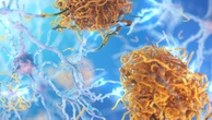 ‘Hope’: Huge leap in dementia treatment