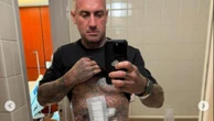 Carey Hart injured in motocross training accident