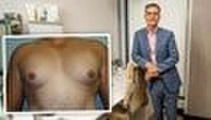 Man-boob and rib removal on rise in WA