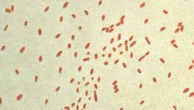 State hit by record outbreak of deadly virus