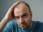 Women find bald men more attractive