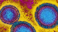 Aussies warned of surge in deadly flu season