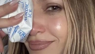 Jennifer Lopez suffers cut and black eye in American Music Awards rehearsals