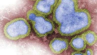 ‘Dire’: Grim warning on deadly flu season