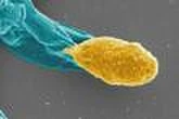 Une piste antibiotique contre une bactérie intestinale récidivante