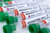 More than 1,000 monkeypox cases recorded in the UK