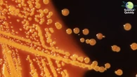 WHO Reports Global Rise in Antibiotic Resistance and Superbug Deaths