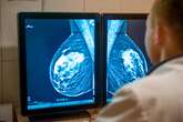 Genetic Discoveries Could Reduce Black Women's Higher Breast Cancer Death Risk