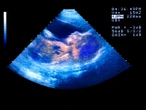 Babies may ‘catch’ yawns from their mother in the womb, new study finds