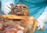 Ötzi the murdered Iceman’s microbiome is still active