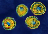 Genital herpes tests are notoriously unreliable, but better ones are in the works
