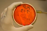 ‘Nightmare Bacteria’ Infections Spiking, Leaving Key Carbapenem Antibiotics Useless, CDC Warns