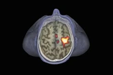 Brains React to Signs of Illness—Even When It’s Not Real