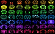Engineered Viruses Are Transforming Neuroscience and Treating Brain Disease