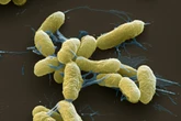 Pneumonic Plague Infections in Modern Times Show the Black Death Isn’t Dead