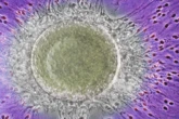 Semen Has Its Own Microbiome--And It Might Influence Fertility