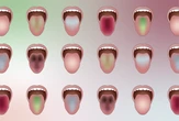AI Scans Tongue Color to Predict Diseases