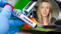 Jesz zdrowo, a "zĹy" cholesterol dalej pod sufitem? KardioloĹźka: to czÄste zjawisko