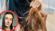Nie czesz mokrych wĹosĂłw, bo siÄ poĹamiÄ? TrycholoĹźka rozwiewa wÄtpliwoĹci