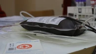 Badania nie kĹamiÄ. Osoby z tÄ grupÄ krwi sÄ zdrowsze niĹź reszta. MajÄ ĹwietnÄ odpornoĹÄ